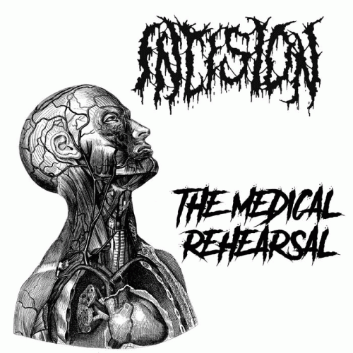 Incision (MEX) : The Medical Rehearsal